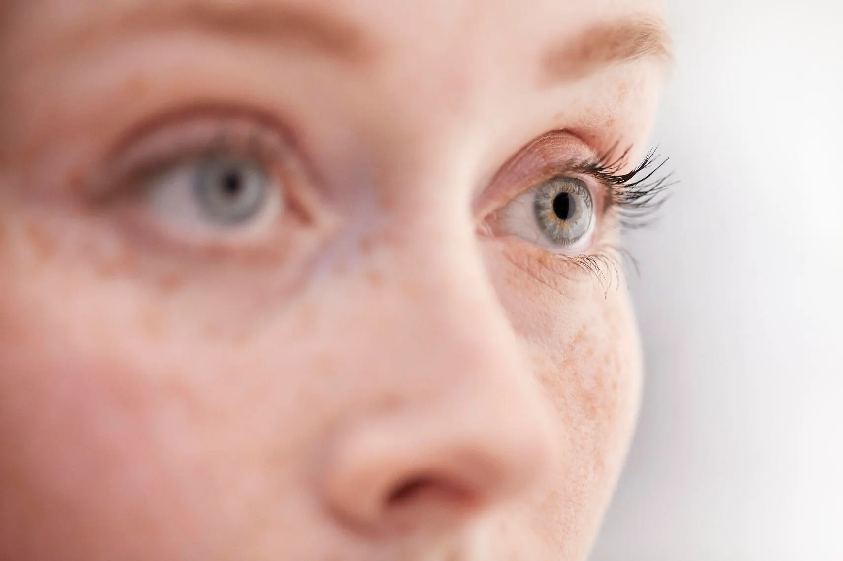 Close up of female patient's eyes