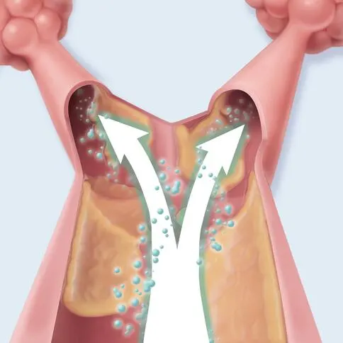 Image demonstrating lung expansion