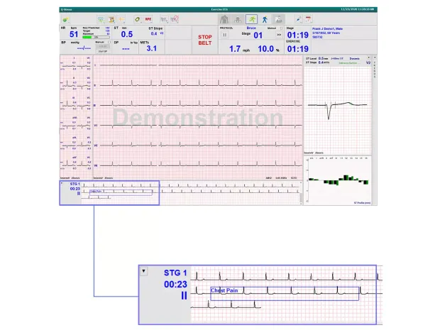Ability to scroll through a stress test with Real-Time Full Disclosure