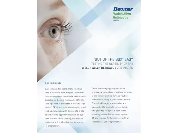Preview of the "Out of the box Easy" RetinaVue Whitepaper