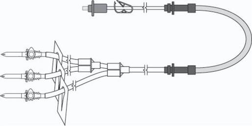 Trifurcated Fluid Transfer Tube Set