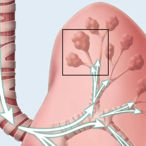 Image demonstrating lung expansion