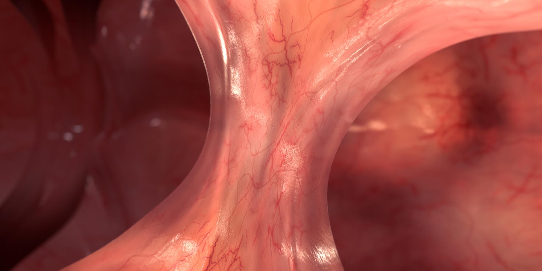 Render of an adhesion