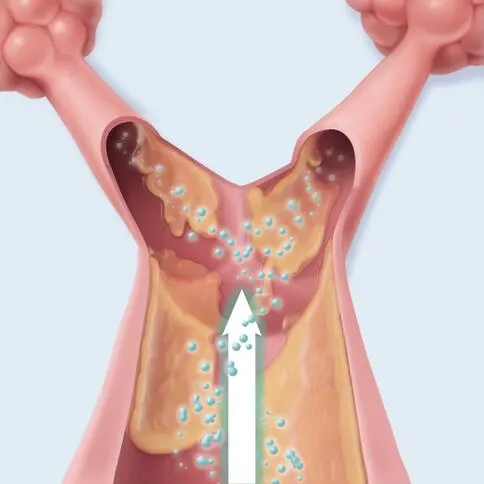 Image demonstrating lung expansion