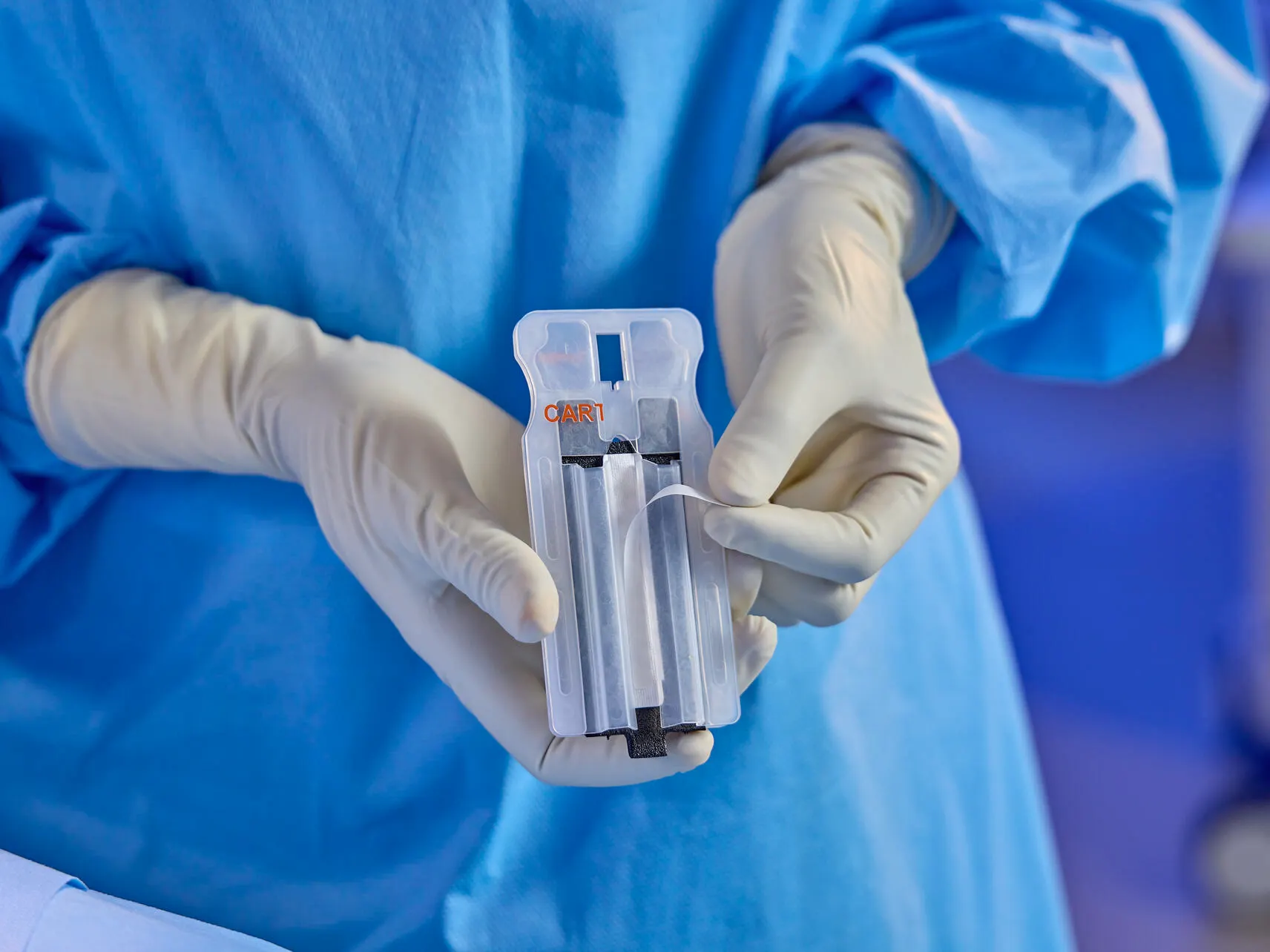 Peri-strips being peeled from the Cassette by a surgeon